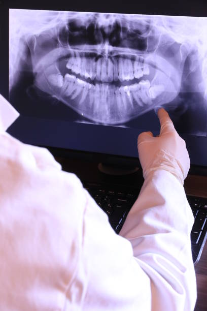 Best Dental Abscess Treatment in Wellington, CO