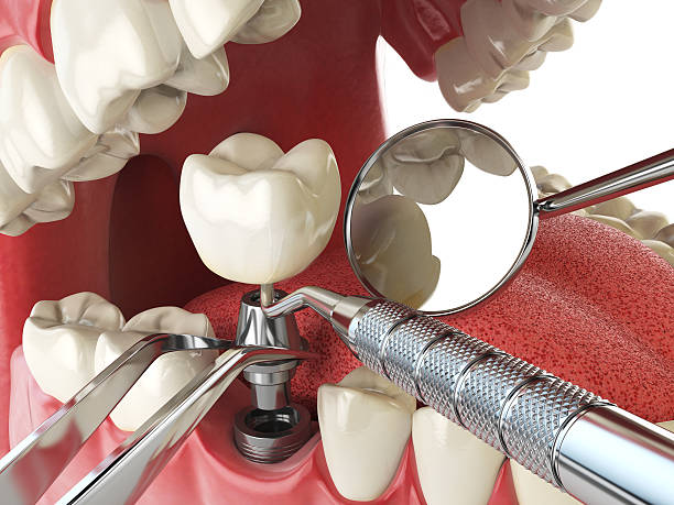 Best Emergency Treatment for Jaw Pain or Injury in Wellington, CO
